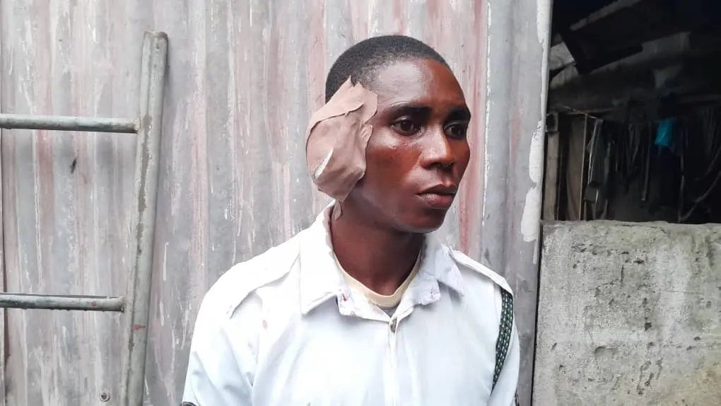 Commercial Driver Flees After Biting Off VIO Officer’s Ear In Delta