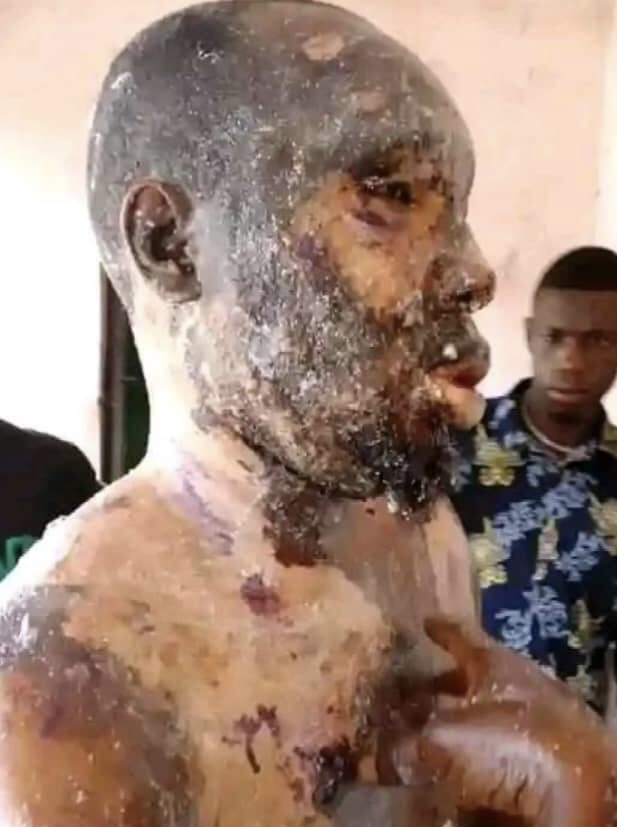 Angry Wife Soaks Husband With ‘Hot’ Cooking Oil While Sleeping In Rivers…Police Launch Manhunt For Her