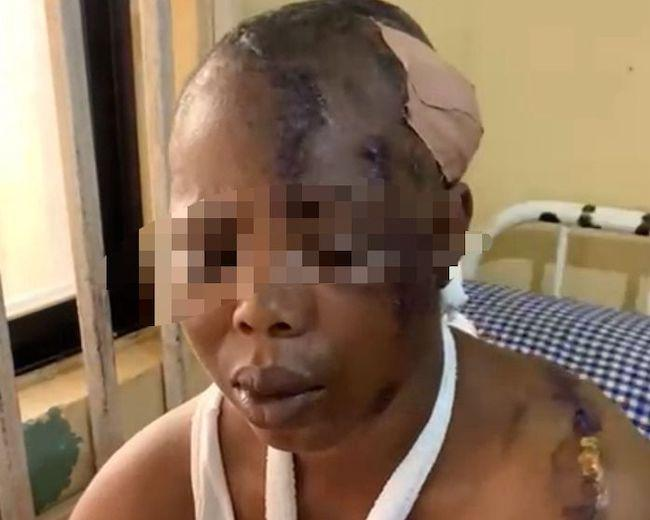Ondo : Man Angry At Wife For Accusing Him Of Sexually  Harassing 14-Year-Old  Stepdaughter ,  Attacks  Her With Cutlass