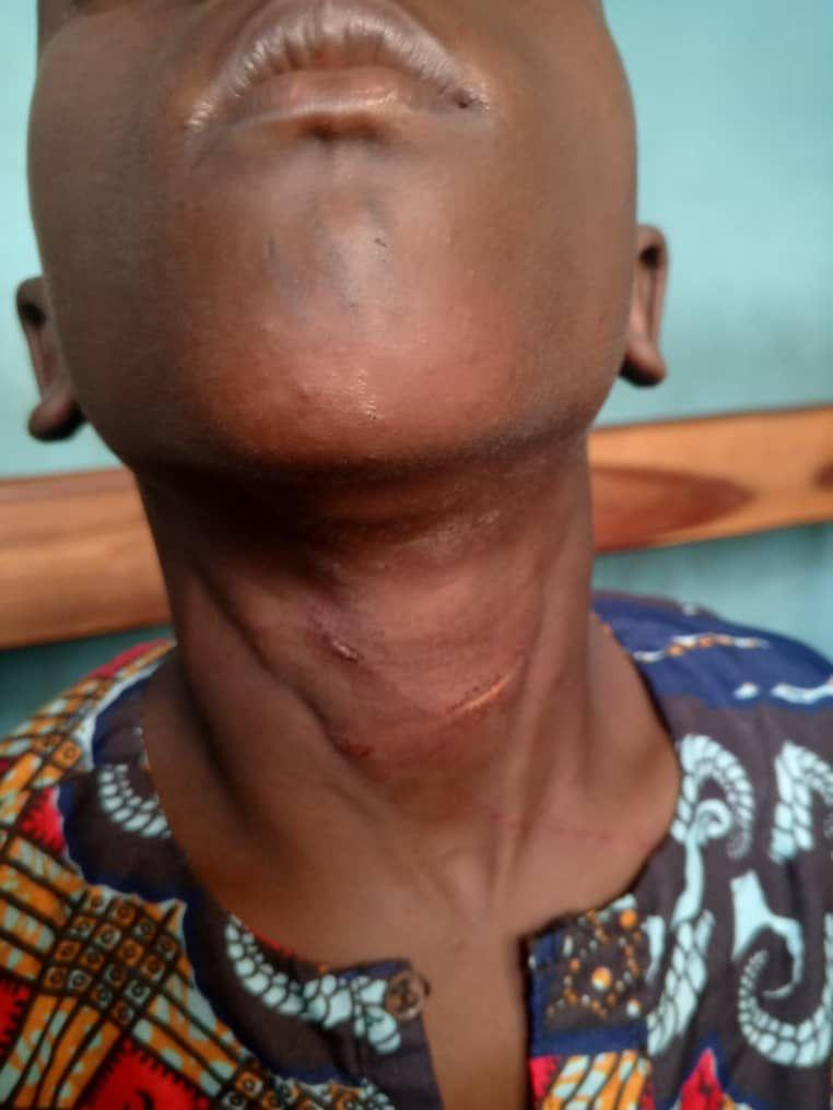 Money Rituals: Man Tricks 10-Year-Old Pepper Seller Into Room In Ilorin, Tries To Knife Him To Death